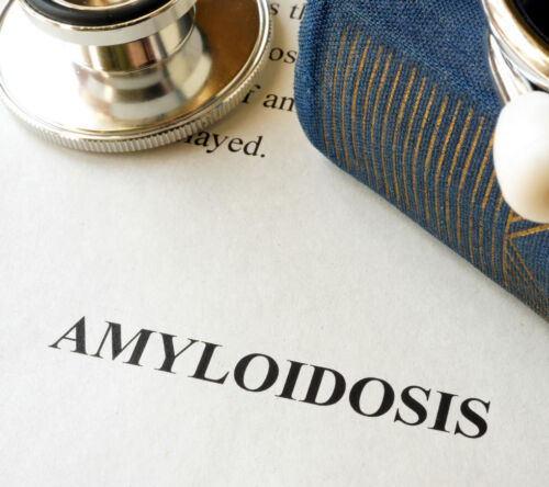 Podstawowe informacje na temat amyloidozy