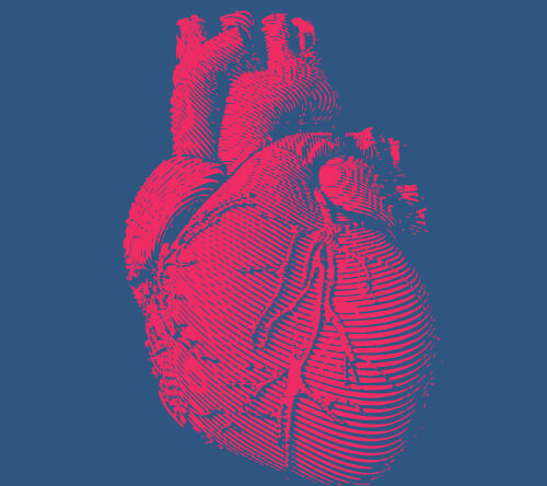 Korzystne wyniki tafamidisu w amyloidozie ATTR serca typu dzikiego