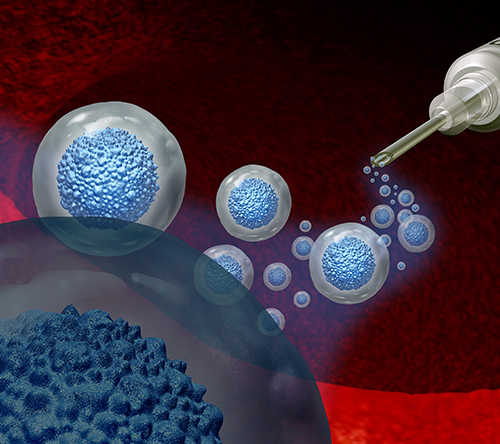 25 lat autologicznego przeszczepiania komórek krwiotwórczych (autoHSCT) w leczeniu amyloidozy łańcuchów lekkich – którzy pacjenci odnoszą największe korzyści?