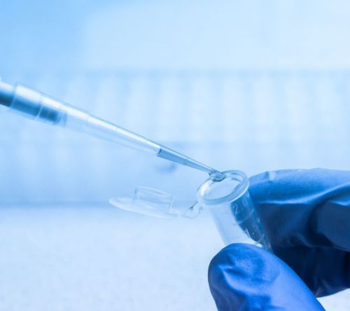 Znaczenie prognostyczne wyjściowego stężenia wolnych łańcuchów lekkich u chorych na amyloidozę w erze nowych leków