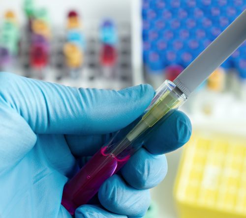 Jak dodanie daratumumabu do schematu CyBorD w pierwszej linii leczenia wpływa na przeżycie całkowite chorych z amyloidozą łańcuchów lekkich? 