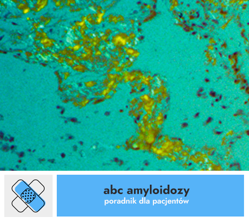 Inne postacie amyloidozy