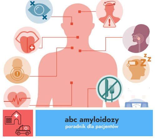 Czym jest amyloidoza AL, jej objawy i symptomy