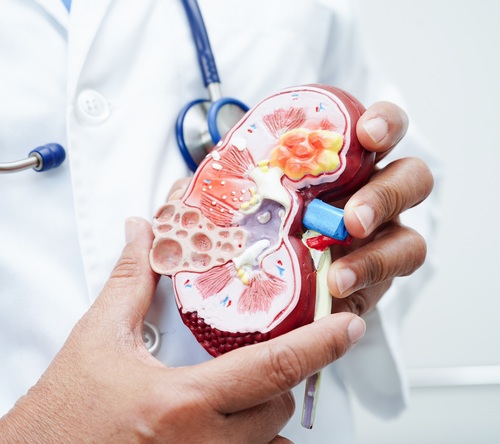 Wpływ na rokowanie ostrego uszkodzenia nerek podczas autologicznego przeszczepienia komórek krwiotwórczych w amyloidozie łańcuchów lekkich