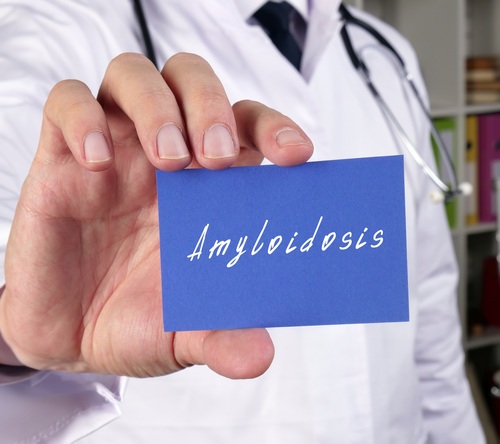 Skuteczność belantamabu mafadotin w nawrotowej uogólnionej amyloidozie łańcuchów lekkich