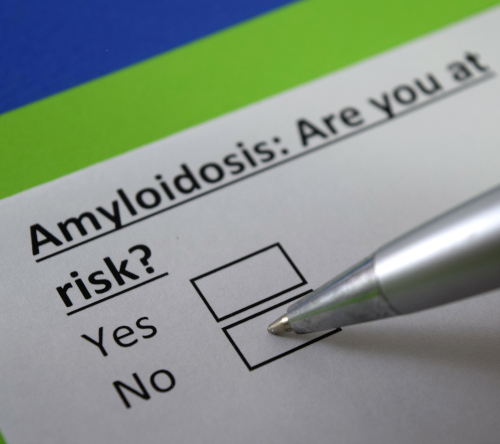 Wyniki autologicznego przeszczepienia krwiotwórczych komórek macierzystych u chorych na amyloidozę łańcuchów lekkich z t(11;14)