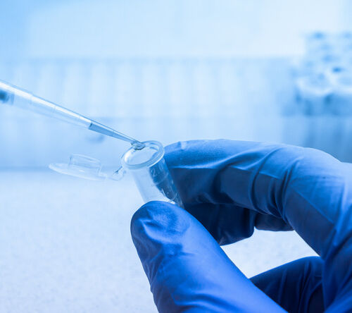 Wpływ leczenia podtrzymującego na odpowiedź hematologiczną i narządową u chorych z amyloidozą łańcuchów lekkich