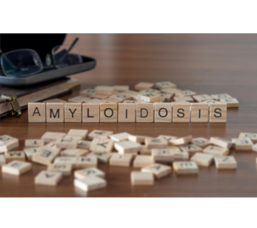 Albuminuria w amyloidozie transtyretynowej z zajęciem serca – jak wpływa na przebieg choroby?