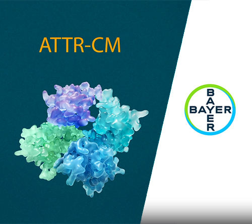ATTR-CM – dlaczego stabilizacja TTR ma znaczenie?