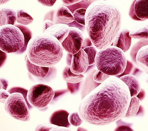 Anemia – co jeść, a czego unikać?