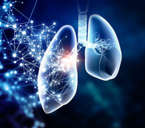 Ocena funkcji płuc i jej wpływ na rokowanie u pacjentów z uogólnioną amyloidozą łańcuchów lekkich