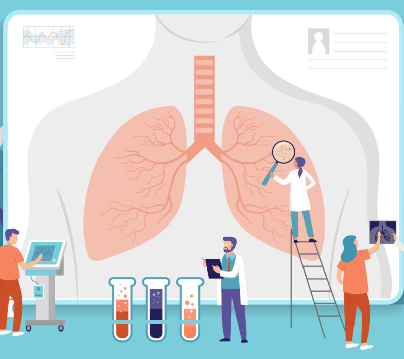 Czym charakteryzuje się wysięk opłucnowy u pacjentów z amyloidozą?