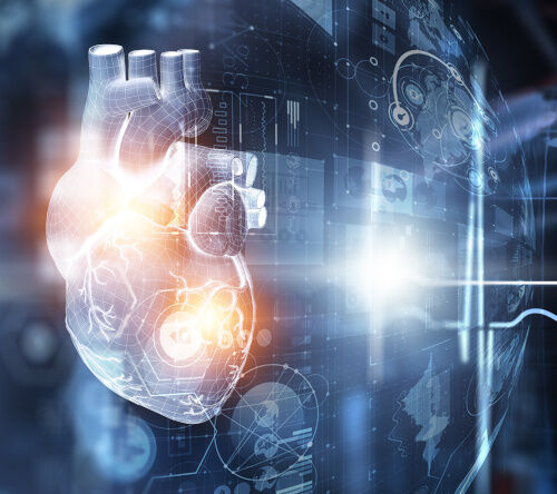 Incydenty zatorowe u pacjentów z kardiomiopatią transtyretynową