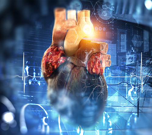 Zwiększona śmiertelność szpitalna wśród chorych hospitalizowanych z powodu migotania lub trzepotania przedsionków ze współistniejącą amyloidozą