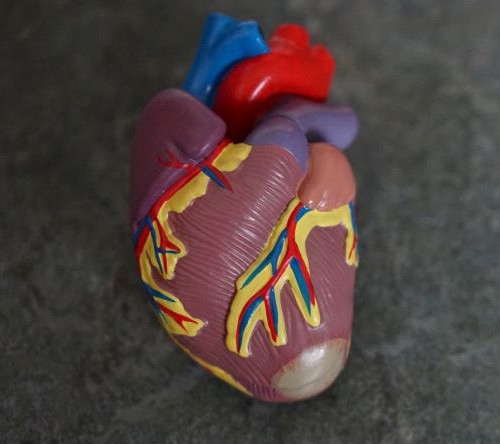 Analiza „real-life” danych klinicznych i przeżycia chorych na amyloidozę łańcuchów lekkich z zajęciem serca